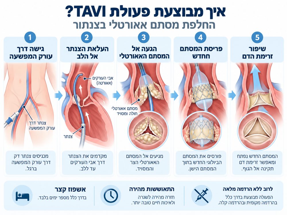 איור 2. שלבי פעולת TAVI – מגישה דרך עורק המפשעה ועד לפריסת המסתם החדש.