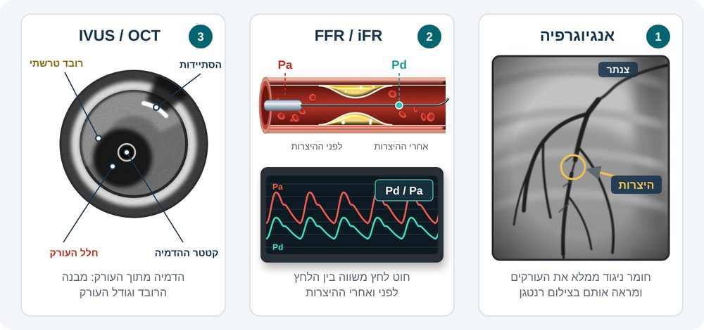 איור 3: כלי האבחון בצנתור – אנגיוגרפיה, מדידה פיזיולוגית והדמיה מתוך העורק